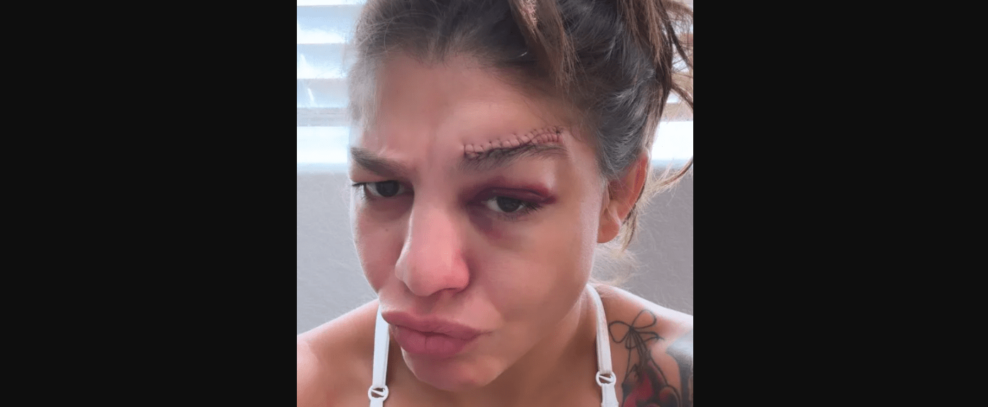 Mayra Bueno Silva reveals off gnarly scar from UFC 303 battle