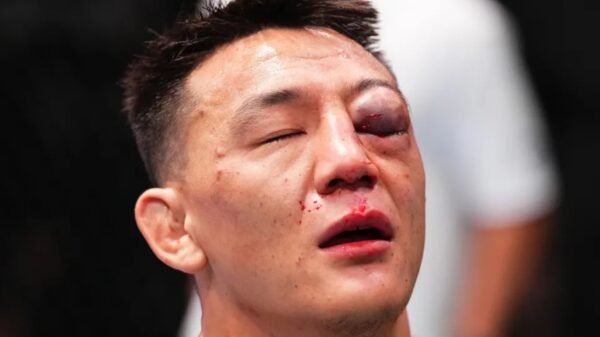 Rongzhu suffered a number of facial fractures in TKO loss to Chris Padilla at UFC Vegas 97