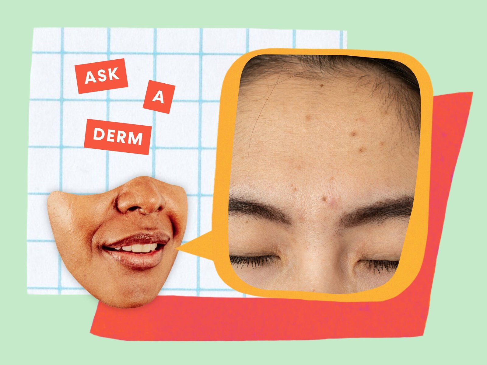 Why Do Pimples Go away Darkish Spots—Even If You Don’t Pop Them? We Requested a Dermatologist