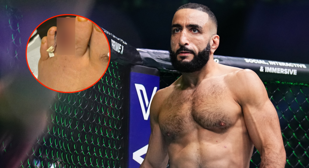 Doctor particulars Belal Muhammad’s bone an infection that compelled UFC 310 withdrawal