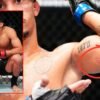 UFC fighter who was disqualified and lower for biting his opponent pronounces return to the octagon… ‘See you quickly’