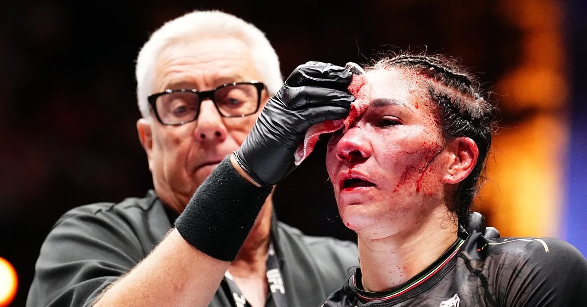 Irene Aldana reveals miraculous restoration from in depth UFC 306 facial accidents