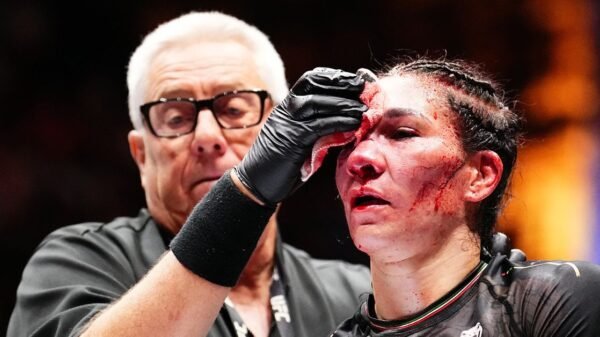 Irene Aldana reveals miraculous restoration from in depth UFC 306 facial accidents