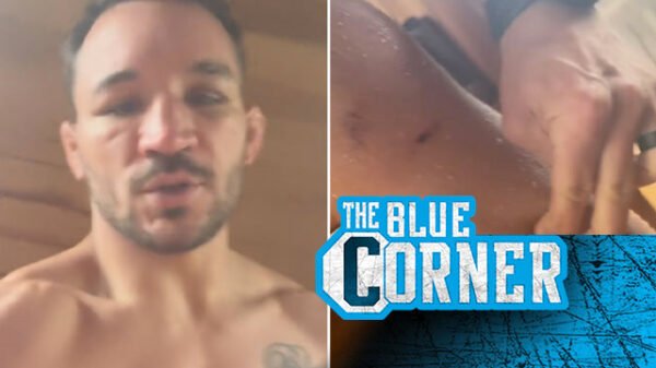 Video: Michael Chandler reveals off insane pitting swelling after UFC 309 Charles Oliveira rematch