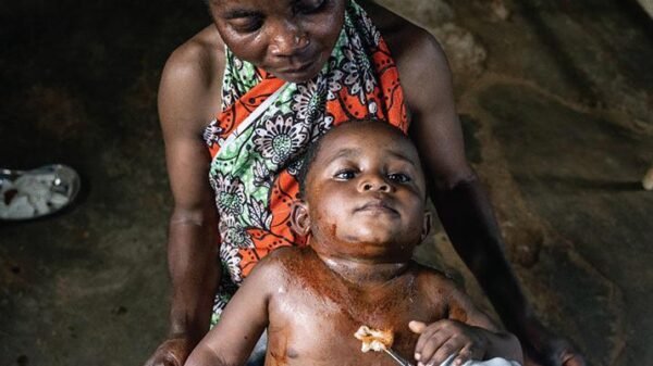 Battle drives mpox epidemic in jap DRC | Science