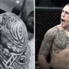 UFC contender riddled with ugly staph an infection