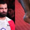 Benoit Saint-Denis addresses staph infection speculation ahead of UFC 329