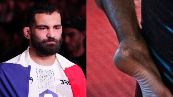 Benoit Saint-Denis addresses staph infection speculation ahead of UFC 329