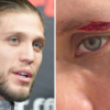 Brian Ortega shares graphic image of cut that forced him out of UFC 331