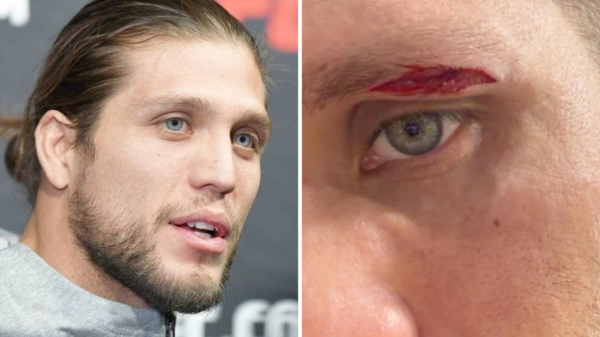 Brian Ortega shares graphic image of cut that forced him out of UFC 331